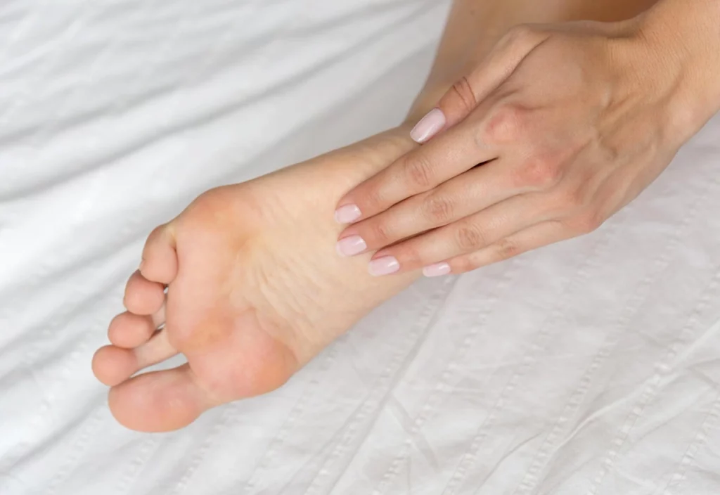 Tratamiento Pie Cavo y Dedos en Garra: Fisioterapia y Plantillas